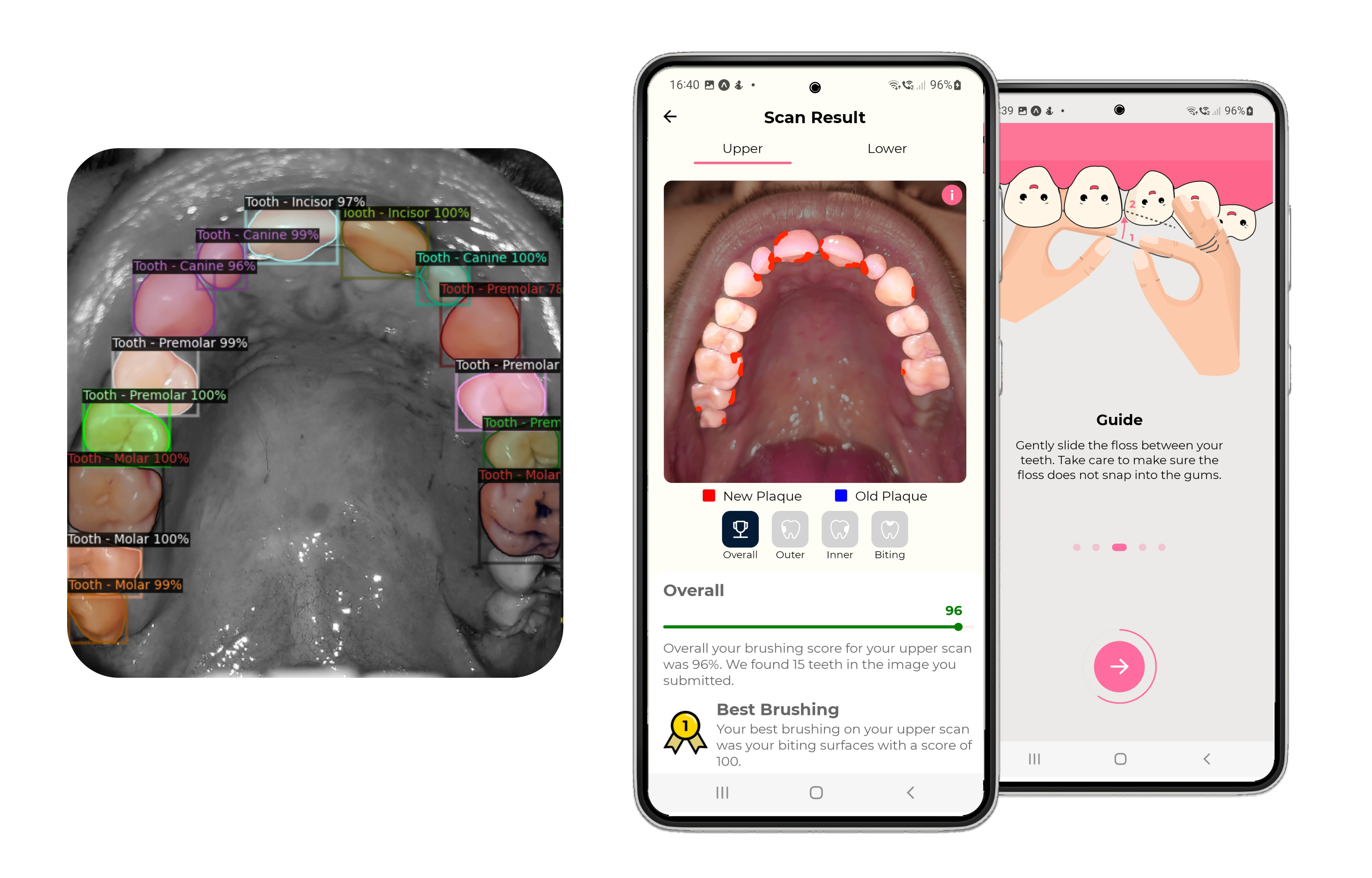 Image of the Testmyteeth AI dental app and custom object detection models